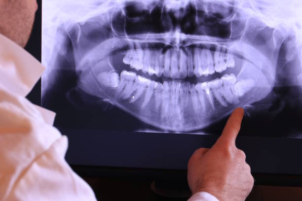 Best Chipped Tooth Repair Near Me  in Beulaville, NC